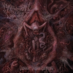 VULVECTOMY (IT) Aberrant Vaginal Gestation CD